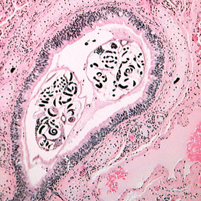 Microscope image of lungworm parasites that infect California sea lions